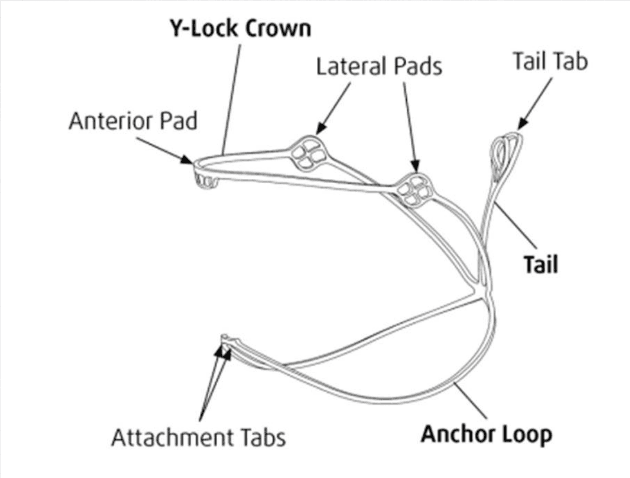 Nitinol Stent