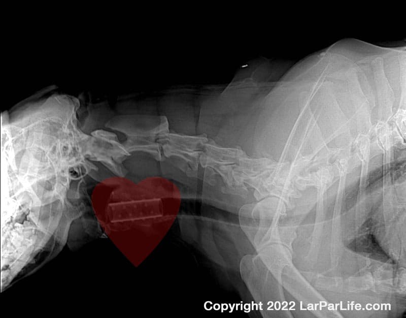 Miss B’s Laryngeal Stent